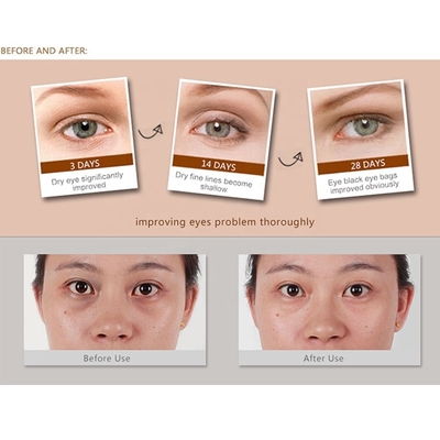 Piel firme sin esfuerzo con ojos vibrante bolígrafo de masaje