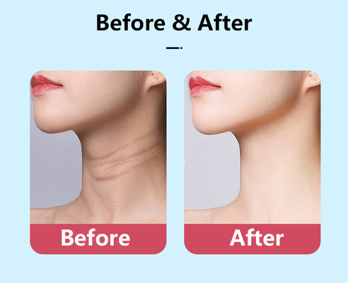 Microcorriente facial EMS Cuello Mascarilla de elevación de cara Equipo de belleza multifunción